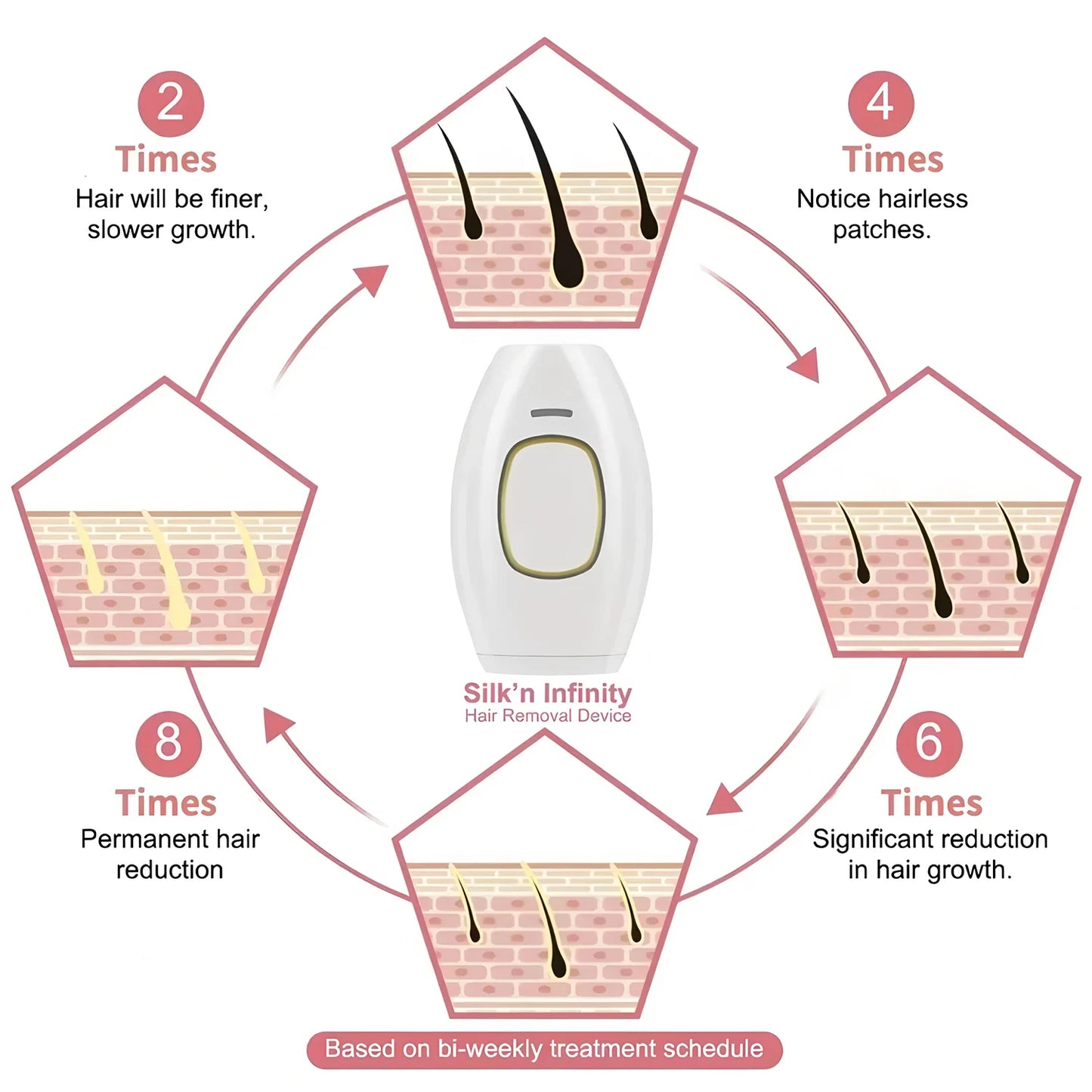 Hair Removal Handset