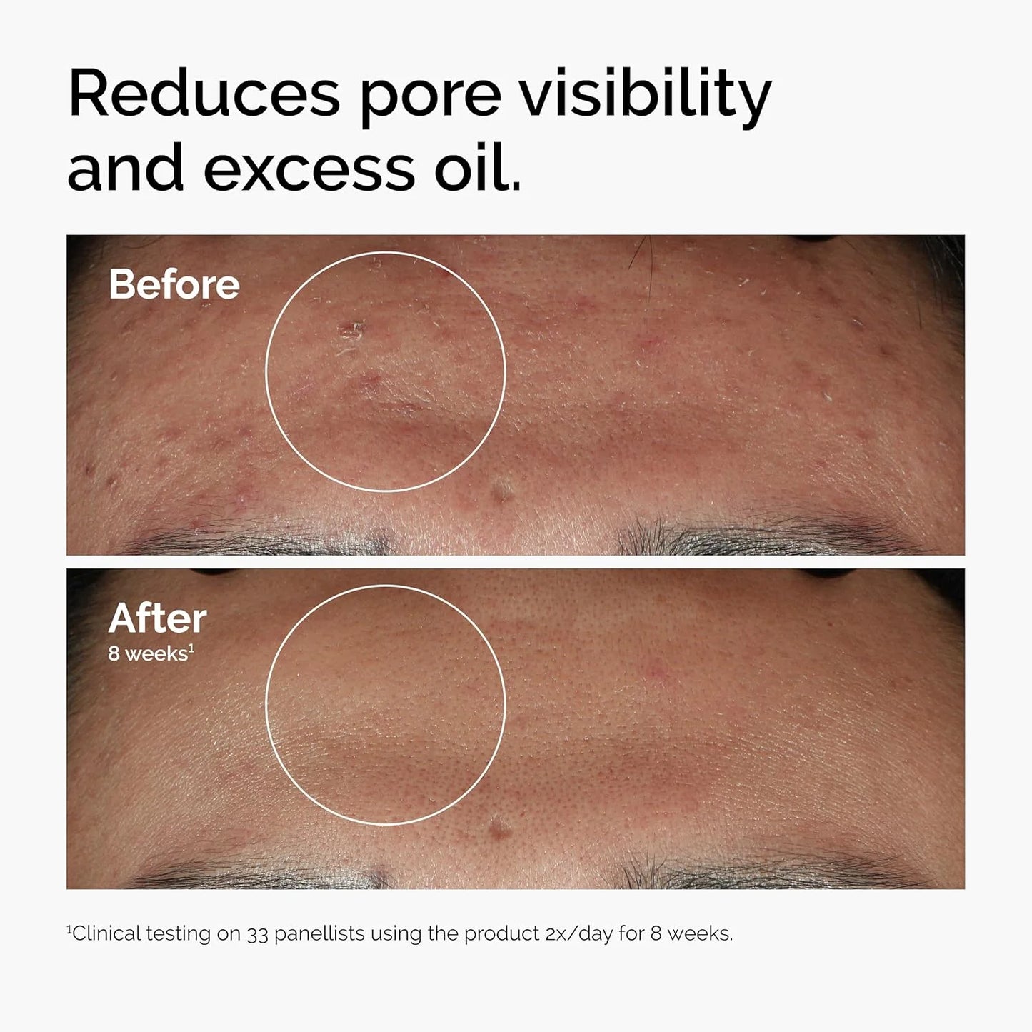 Skin Serum