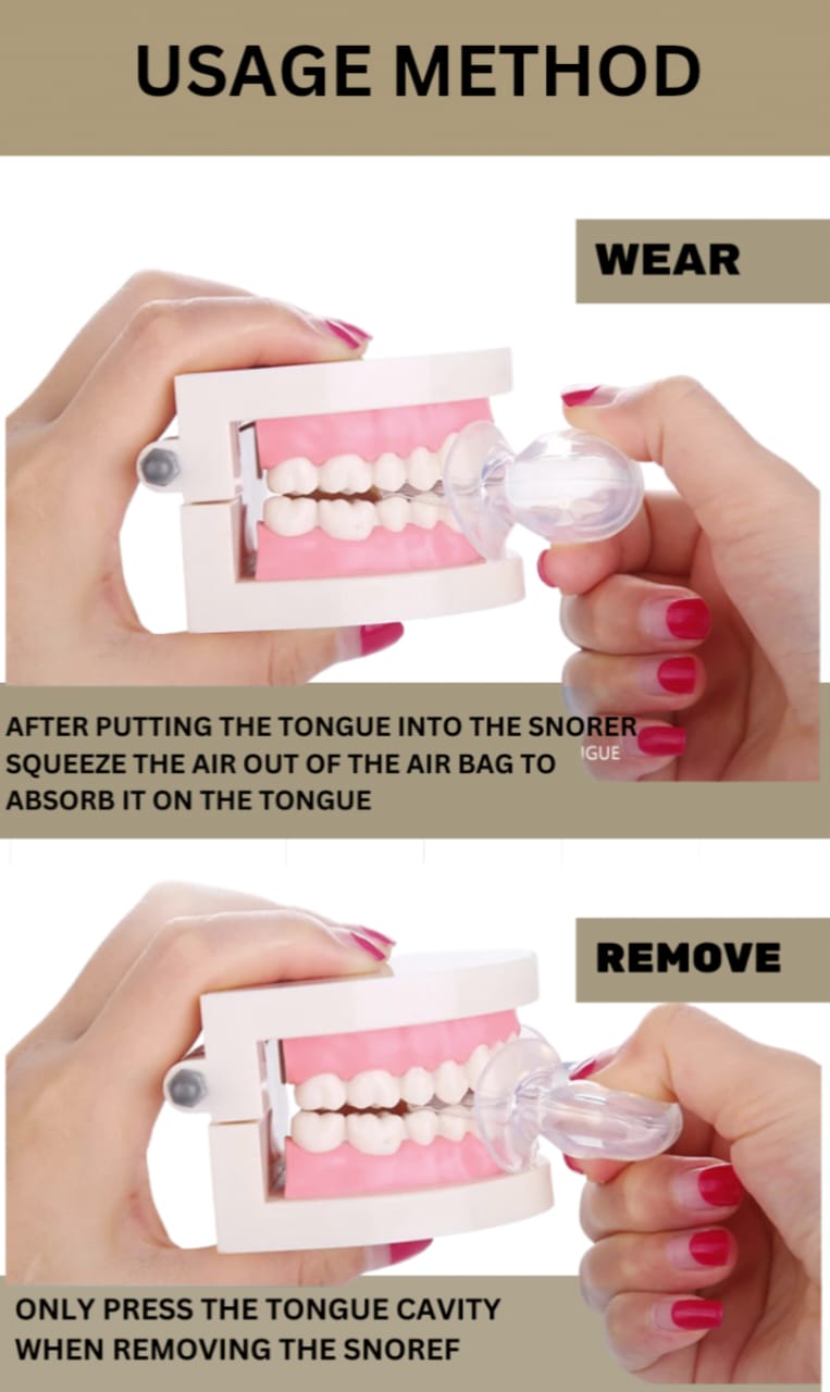 Anti-Snore Tongue Aid